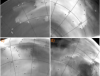 Рельеф поверхности влияет на динамику атмосферы Венеры на высоте 100 км